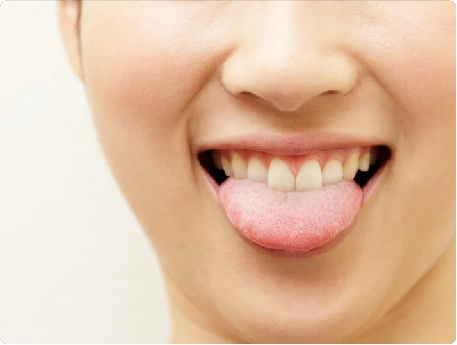How to Eliminate Phlegm-Dampness and Excess Water in the Body?