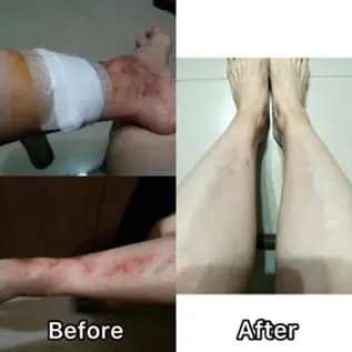 Breaking Free from a Decade of Chronic Illness